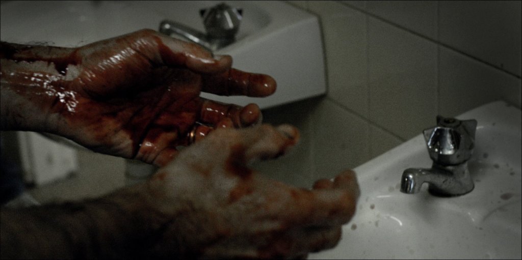 bloody hands